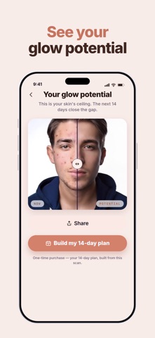SkinFix - Your Skintracker iPhone screenshot