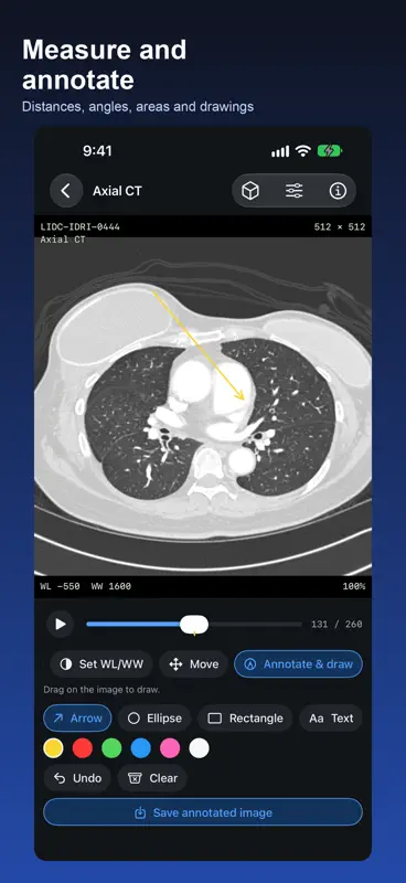 DICOM Viewer: DCM & MRI Reader screenshot 3 of 6