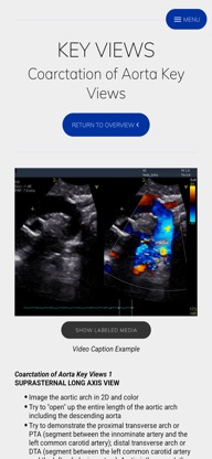 UK Congenital Echo Guide screenshot 4