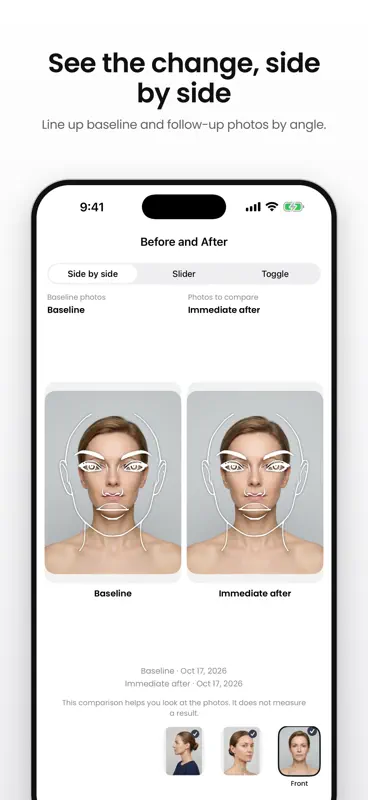 Injector Planner: Mapa Botox screenshot 3 of 8