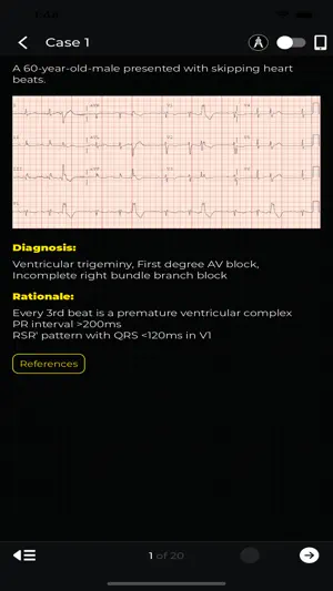 ECG Corner screenshot 2
