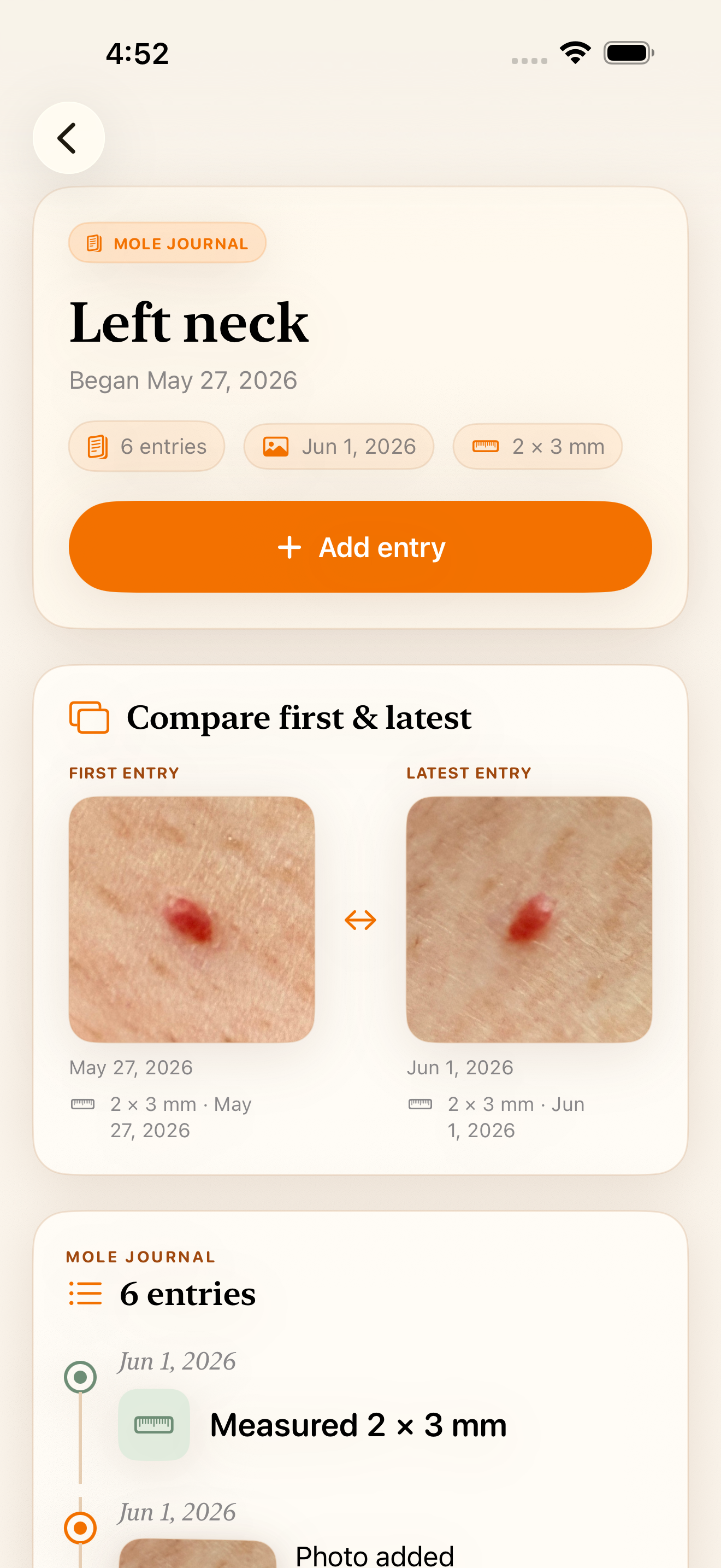 MoleJournal screenshot 3