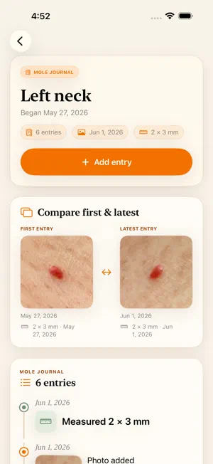 MoleJournal screenshot 3
