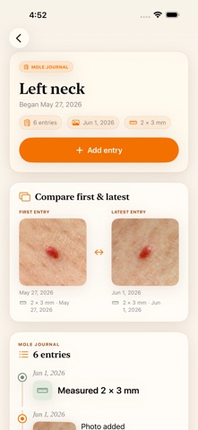 MoleJournal screenshot