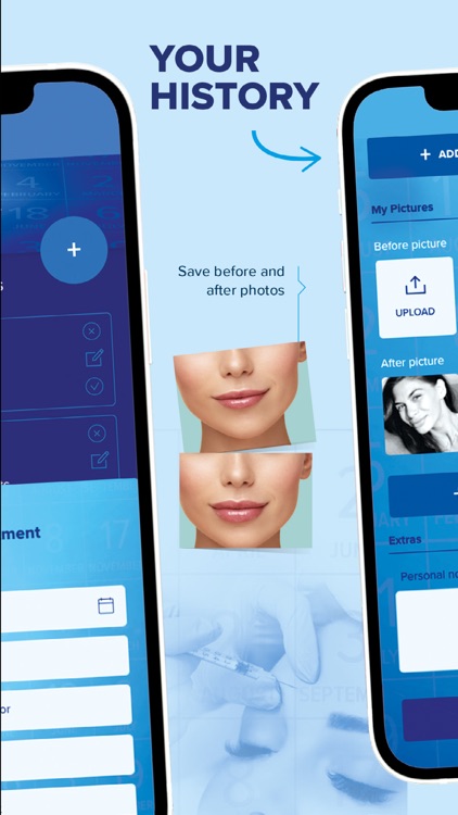 Injectify