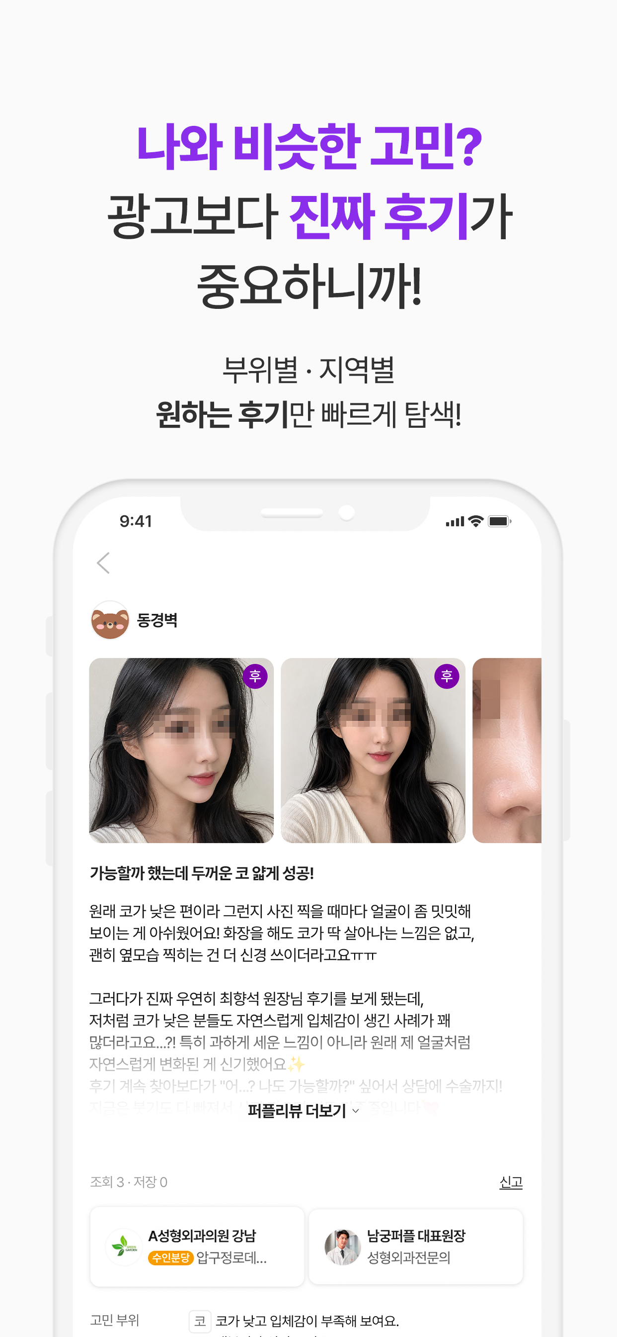 퍼플영-나만의 성형·시술 퍼플플랜