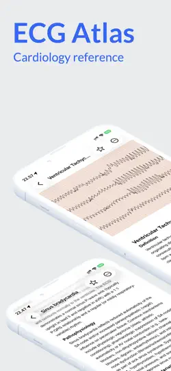Screenshot von ECG Atlas auf dem iPhone 1