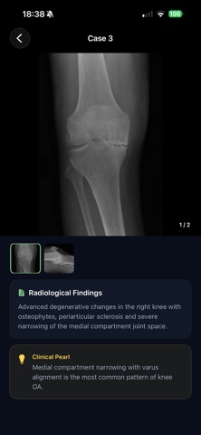 iXRKnee screenshot