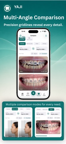 YAJI - Braces & Aligner Log Screenshot 3 of 5