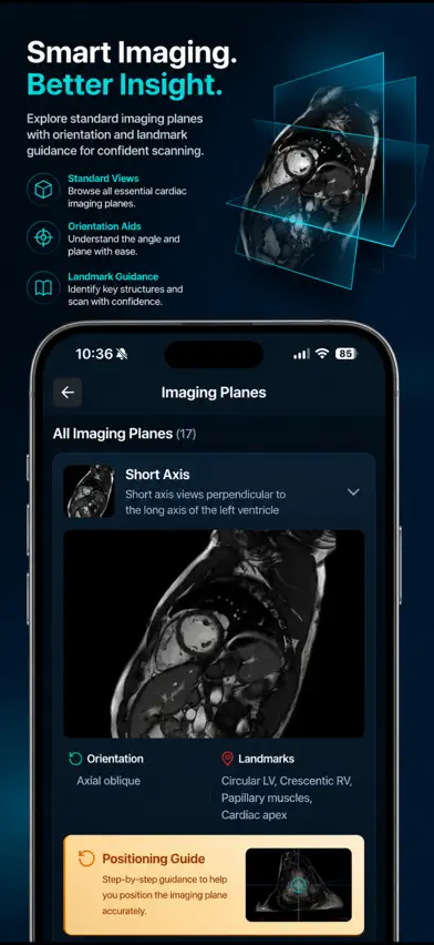 MyoScan IQ: Cardiac MRI Guide screenshot 5