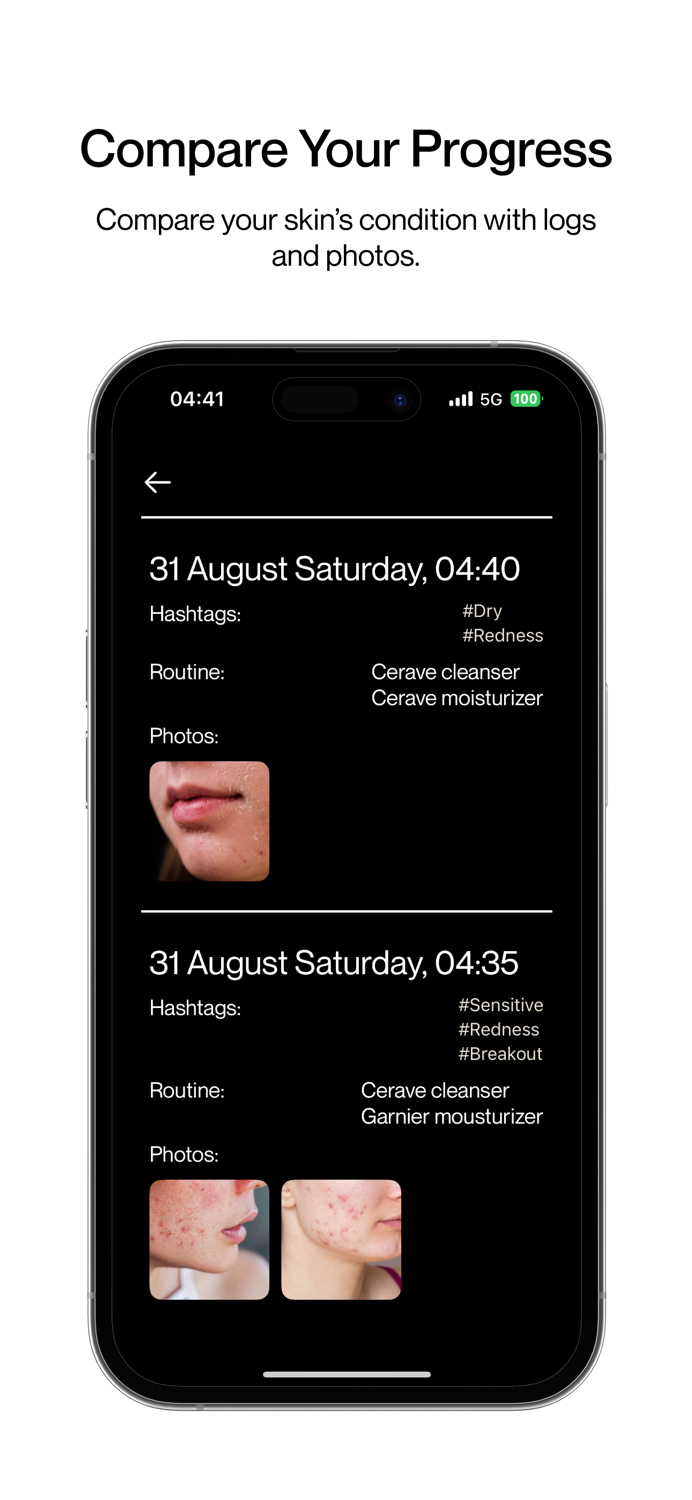 Skin Diary Track  Glow