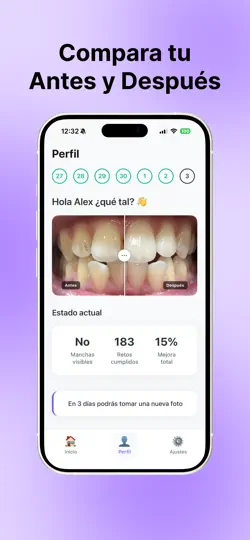 Captura de pantalla de Blanq Ai: Blanquea Tus Dientes en iPhone 4