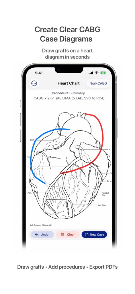 Heart Chart - Medical App | MWM