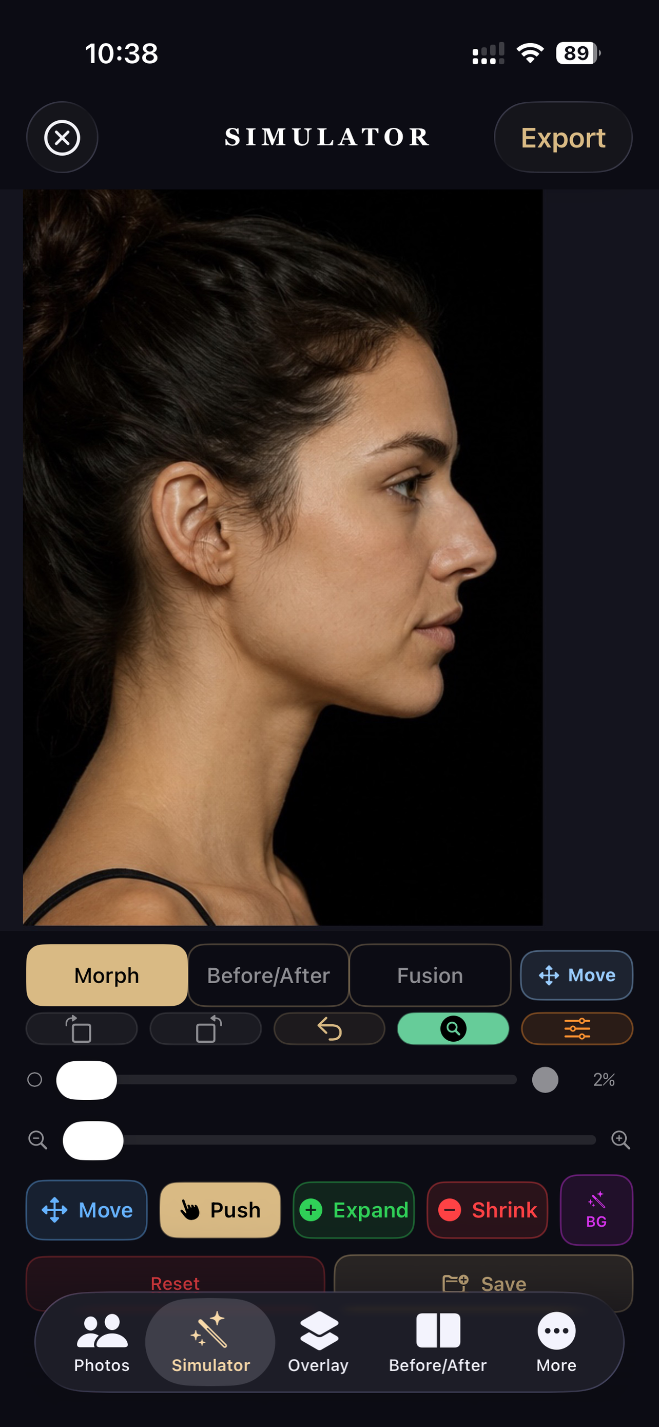 Rhinoplasty Simulator Pro