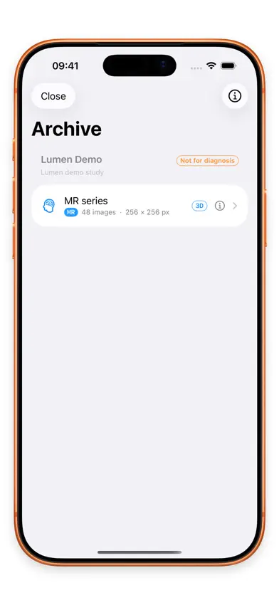 Lumen — DICOM viewer screenshot 3
