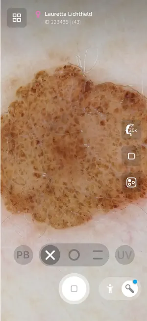 DermLite screenshot 4