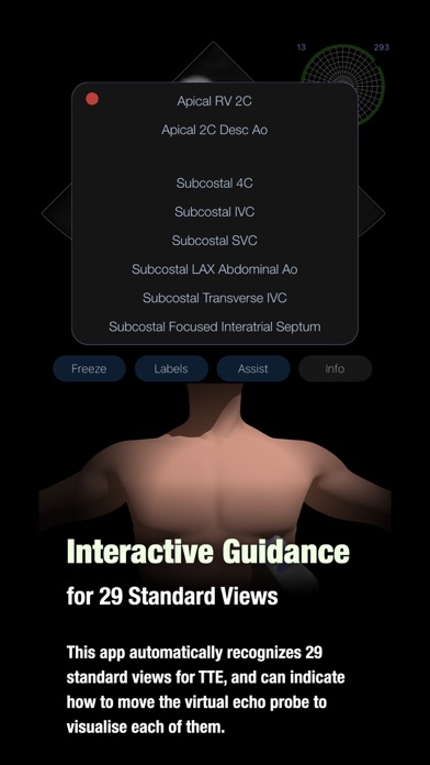 TTE PoCUS Simulator Screenshot