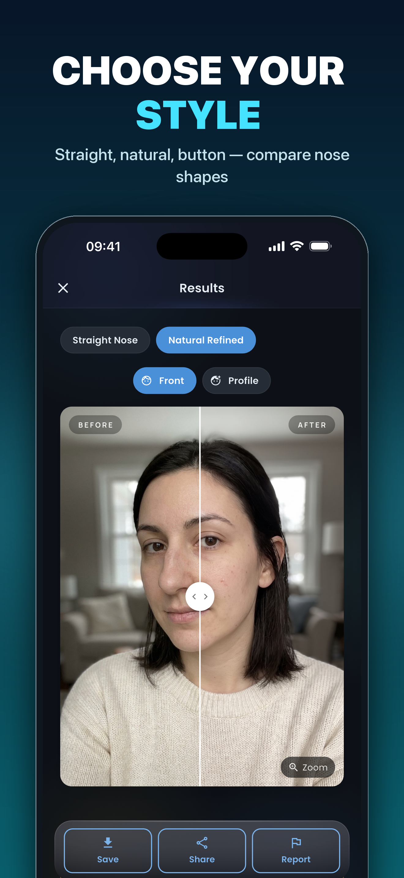 Nose Job - Plastic Surgery AI screenshot 5