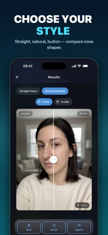 Nose Job - Plastic Surgery AI screenshot