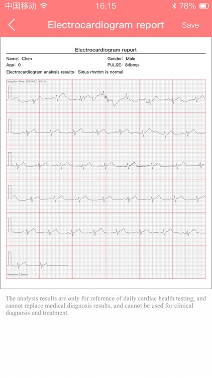 BP+ECG screenshot-4