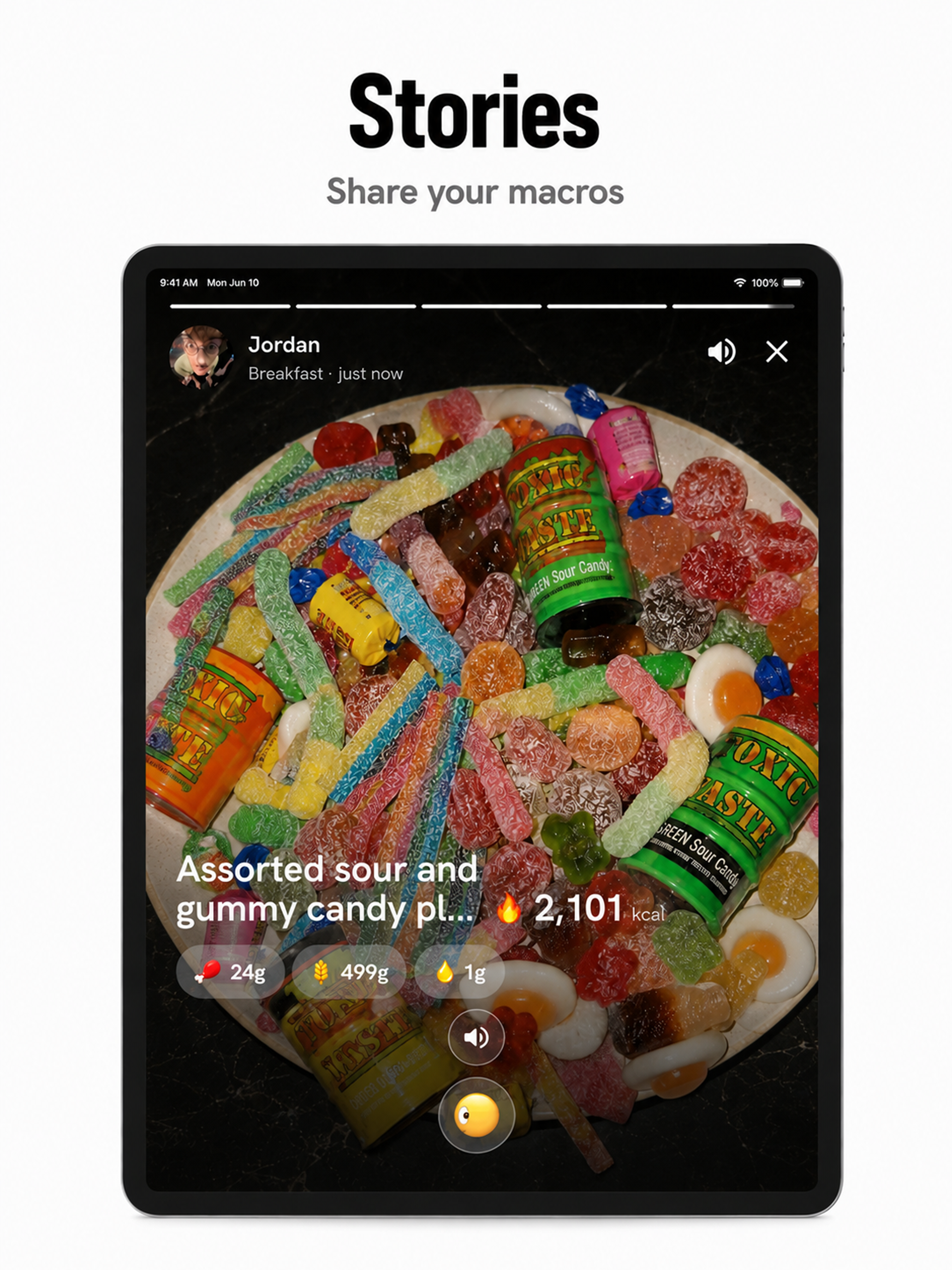SnapDiet AI: Track & Share screenshot 9