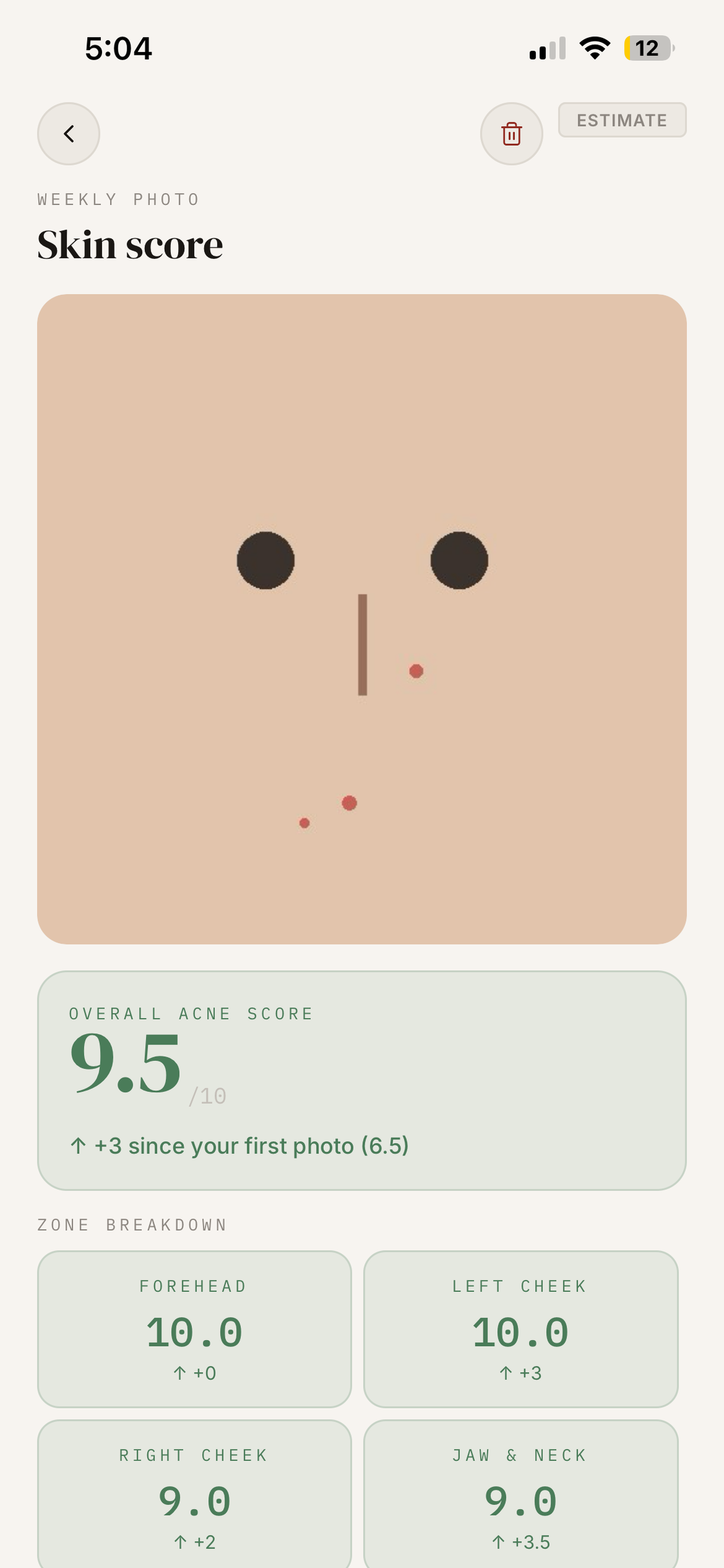 Trigger: Skin Tracker screenshot 3