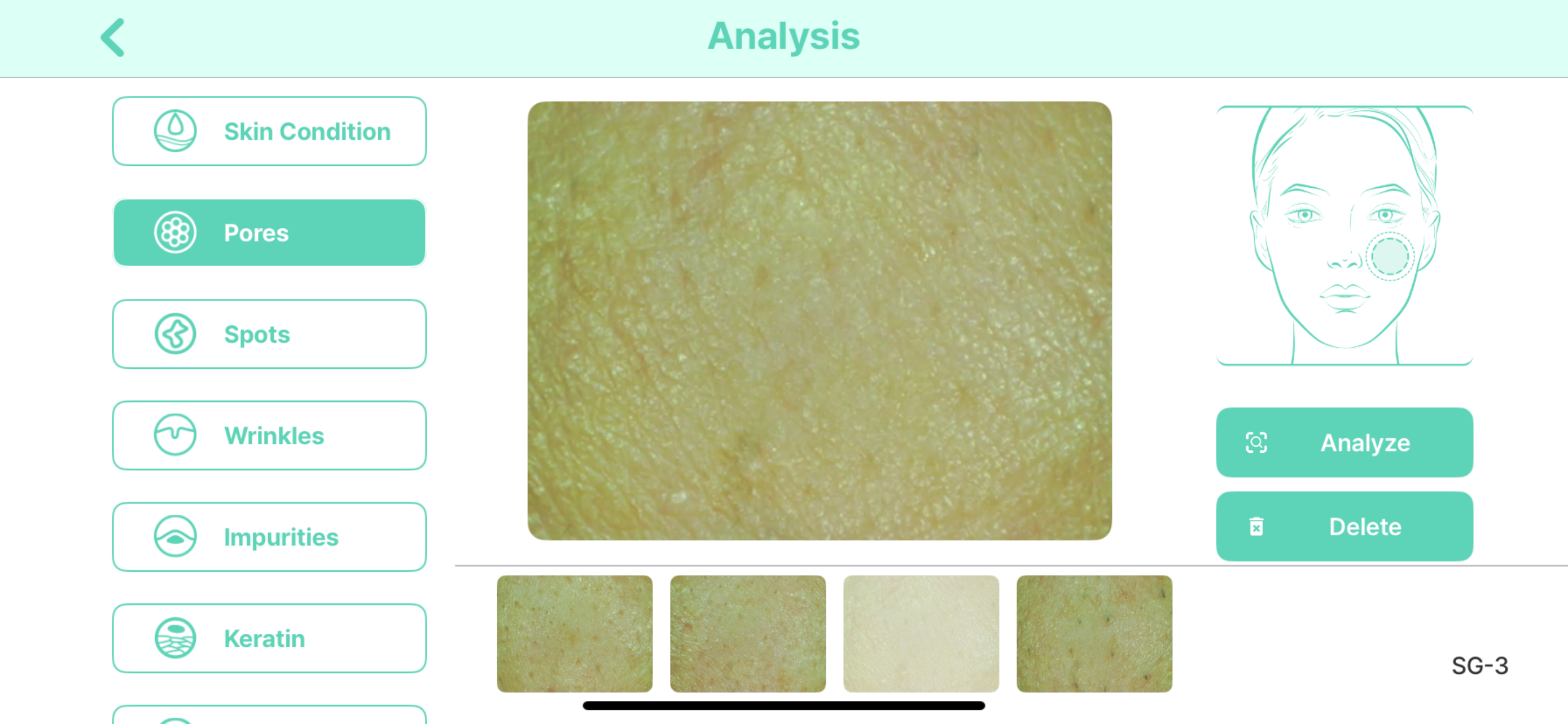 ChoiceDx Pro-Skin2 screenshot 3