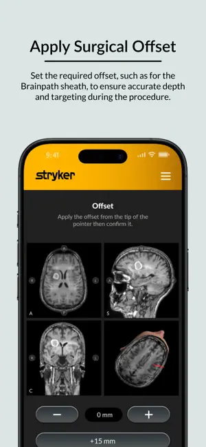 Brain Target Guidance screenshot 4