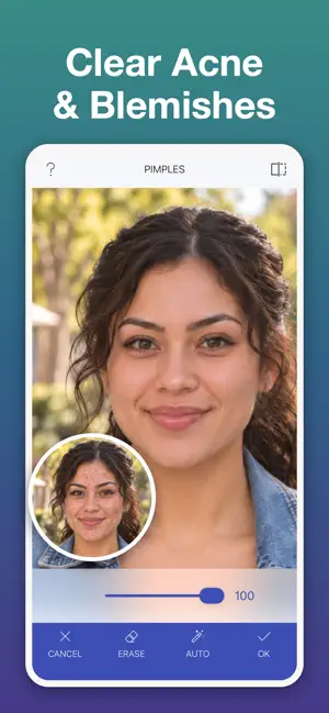 Face Editor: AI Pimple Remover screenshot 4