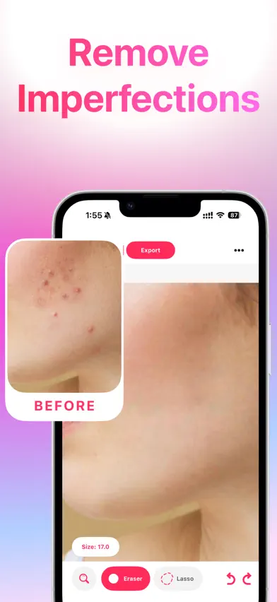 Blemish Remover· screenshot 2