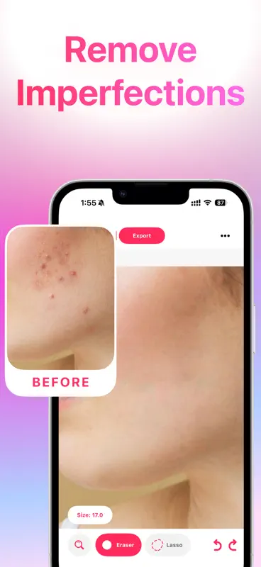 Blemish Remover· screenshot 2 of 4