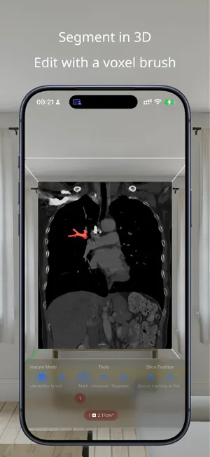 VoxelVision AR Medical Imaging screenshot 3