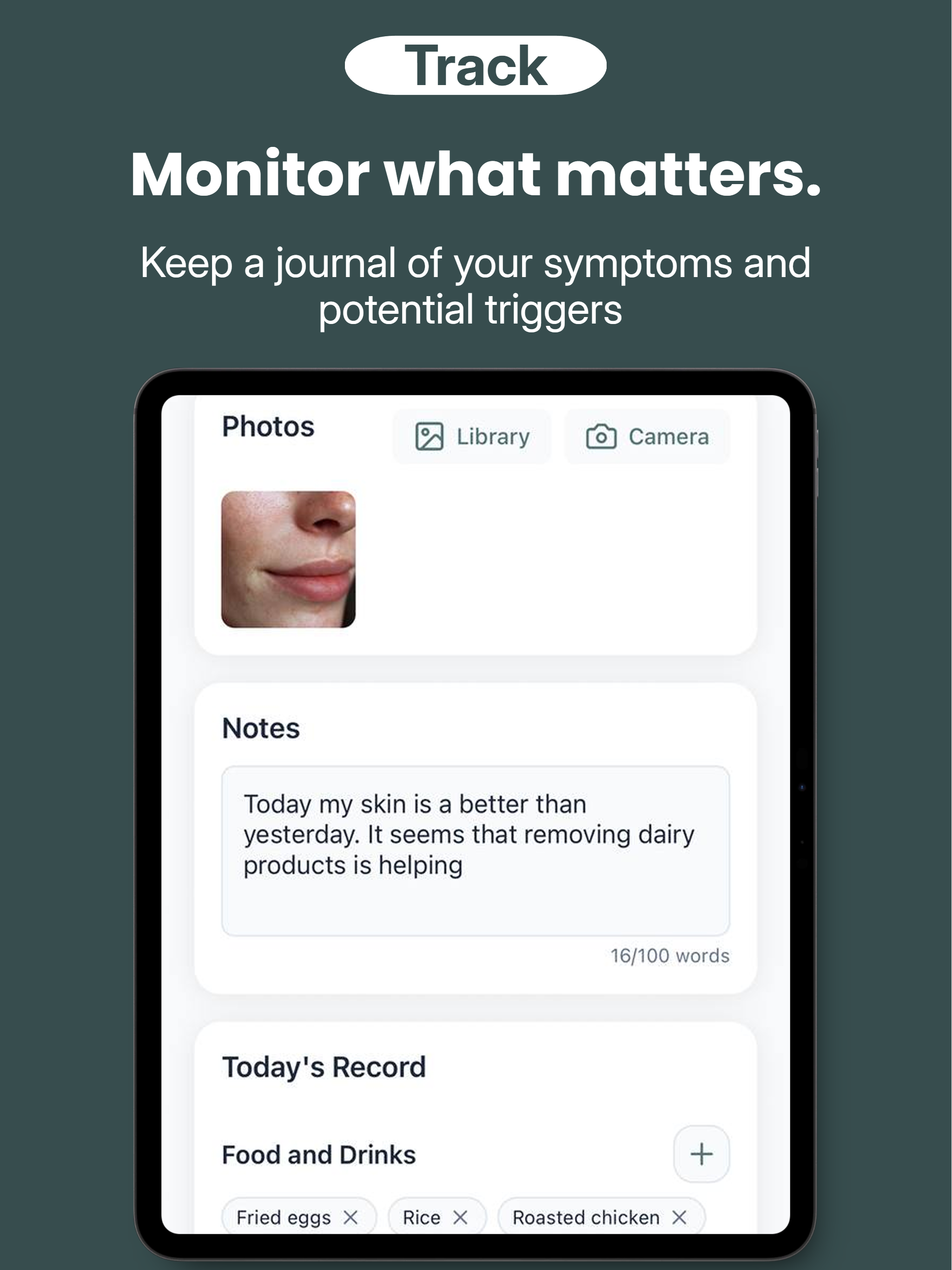 Skin & Acne Tracker - MyGlow
