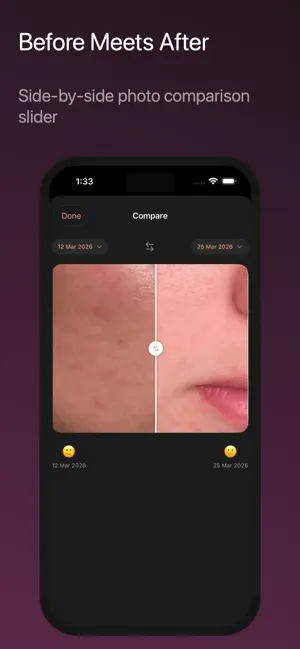 GlowLog — Skincare Tracker screenshot 4
