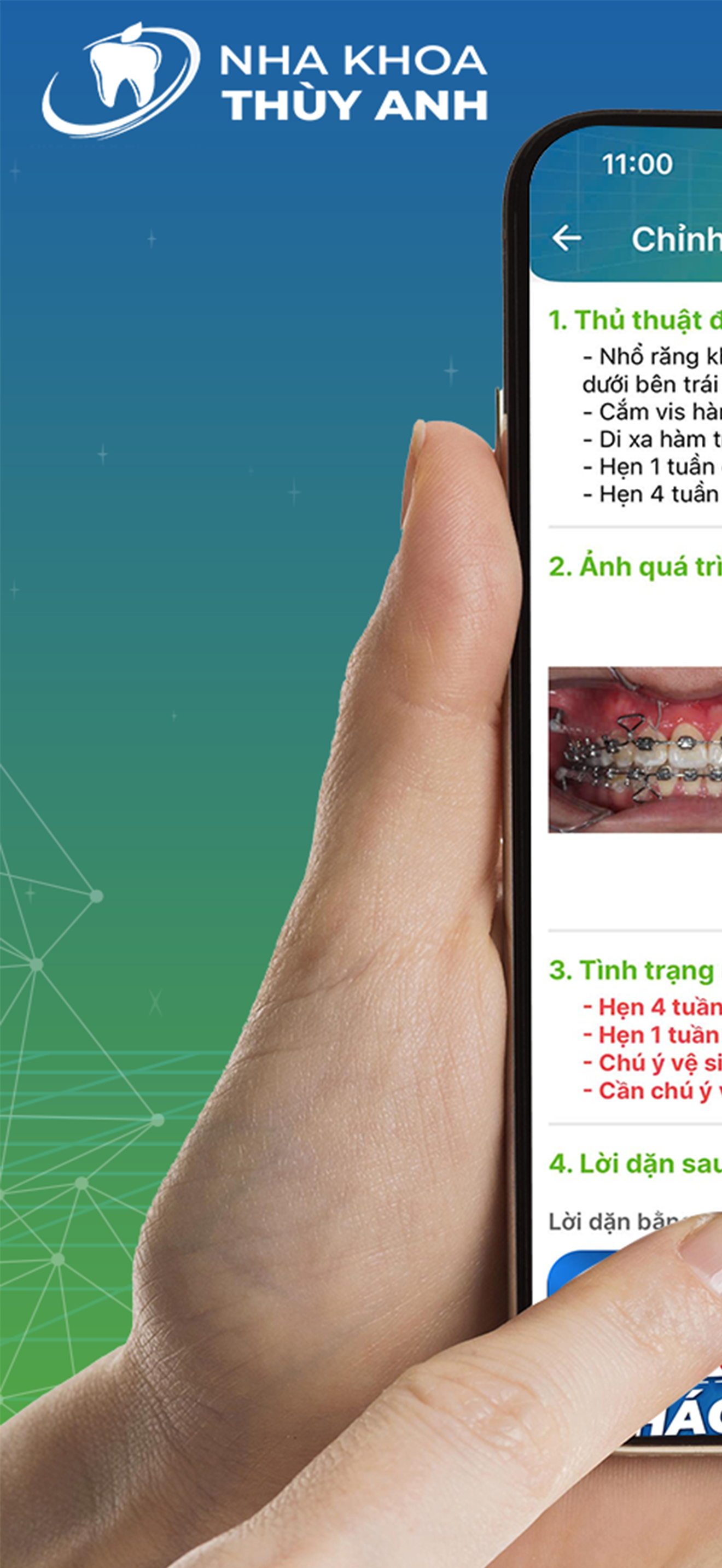 My Braces: Niềng răng Thùy Anh screenshot 5