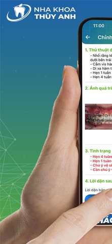 My Braces: Niềng răng Thùy Anh screenshot