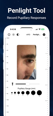 VOMS: Vestibular Ocular Motor screenshot