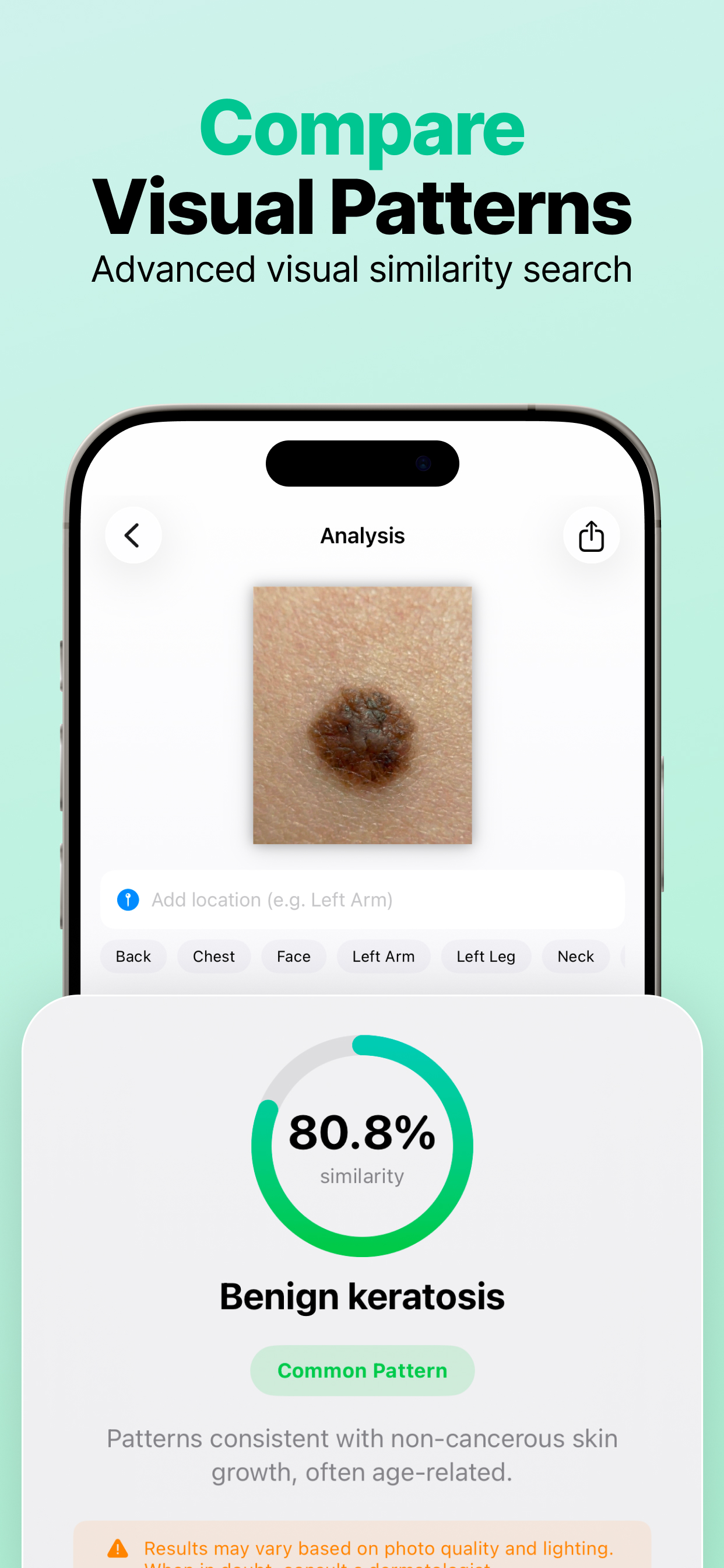 AI Mole Analyzer screenshot 2