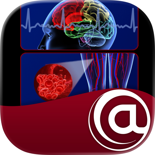 Stroke Prevention in AFib