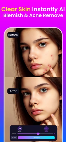 Object Remover - Retouch Photo Screenshot 8 of 10
