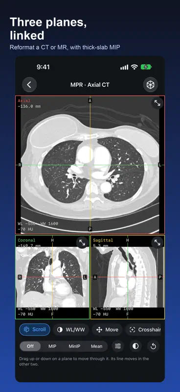 DICOM Viewer: DCM & MRI Reader screenshot 4 of 6