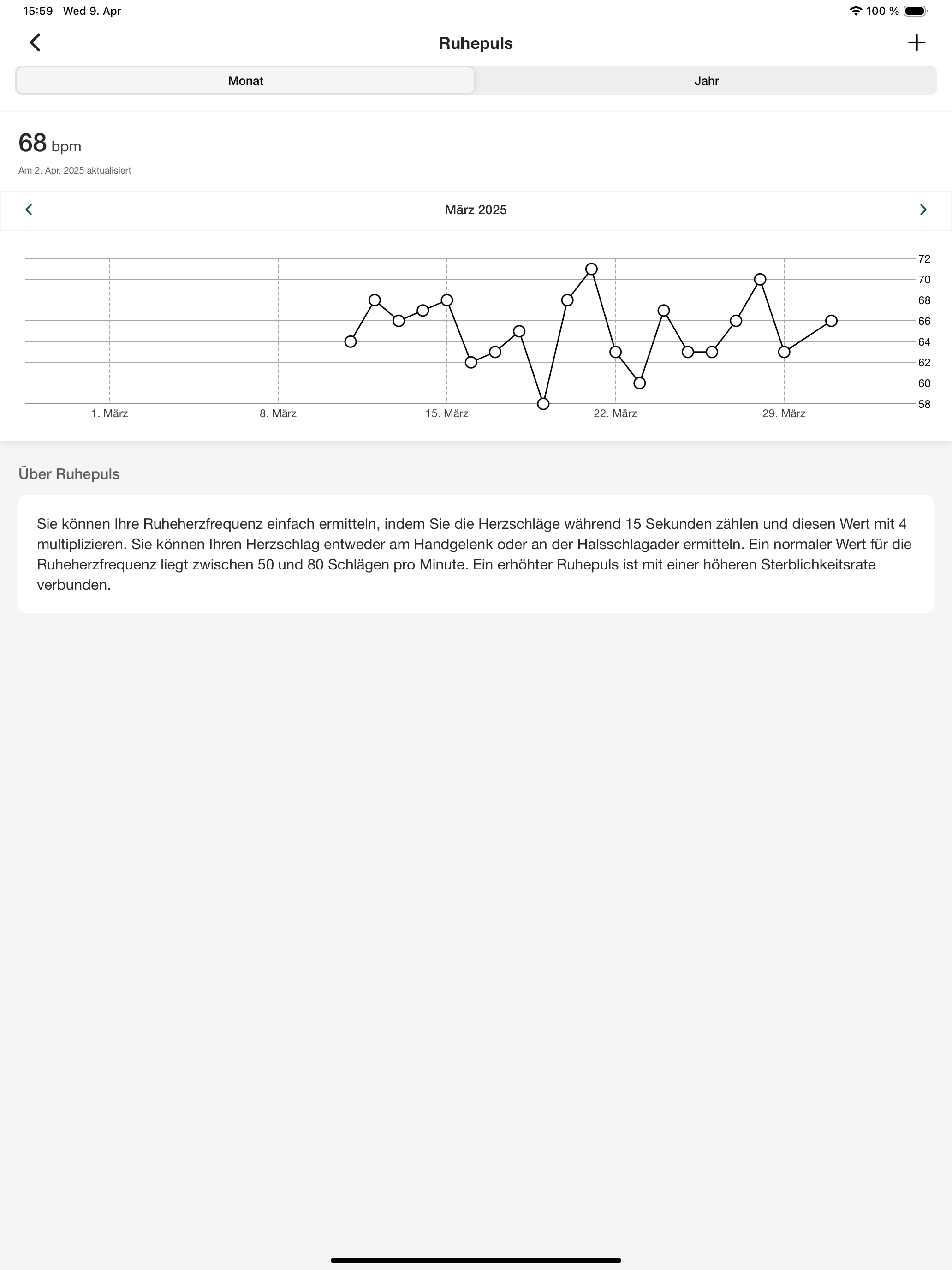 Midiflow Transposer (Audiobus)