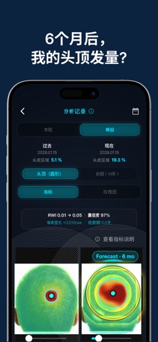 GrowAgain - AI密发助手 screenshot
