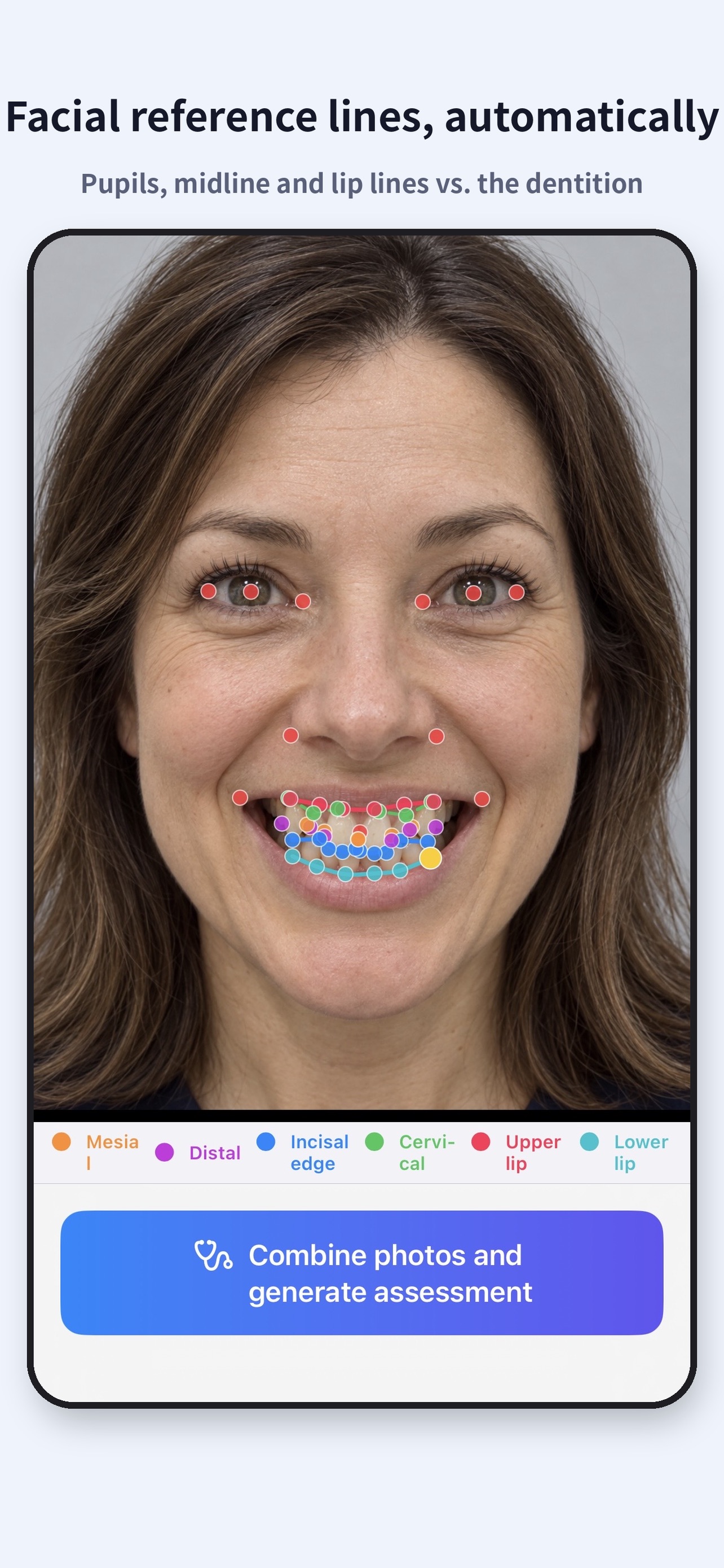 Screenshot 7 of Dental Smile Analyzer