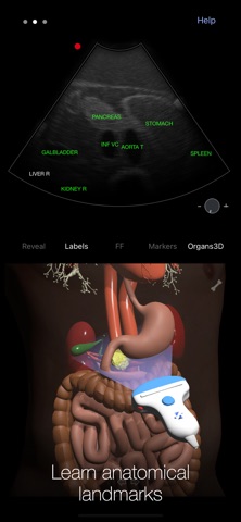 PoCUS Pocket Trainer Screenshot 2 of 5
