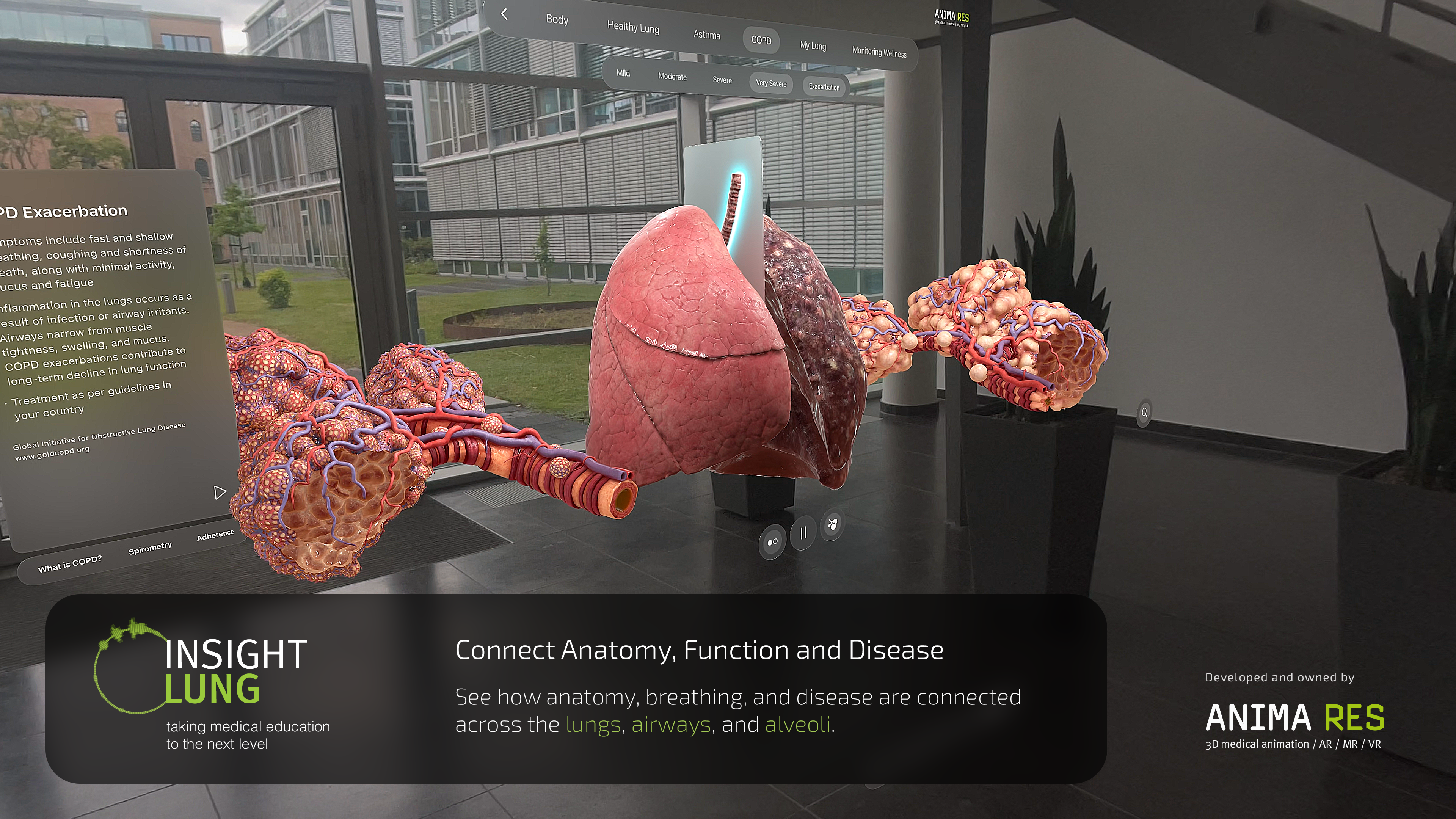 INSIGHT LUNG screenshot 20