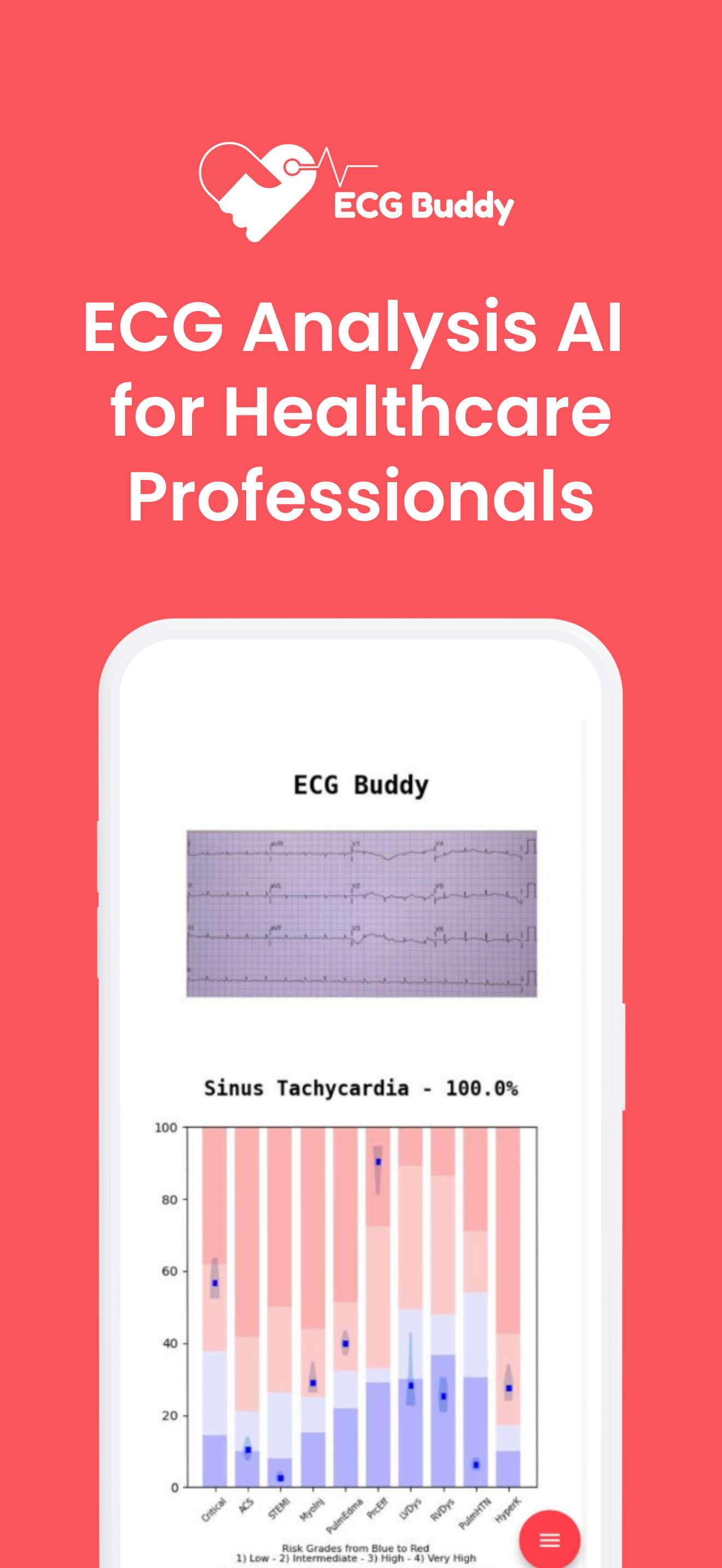 ECG Buddy