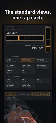 AngioView iPhone screenshot 3