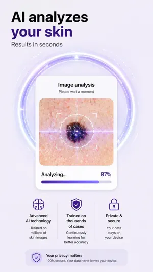 Skin Scanner AI: Mole Check screenshot 3