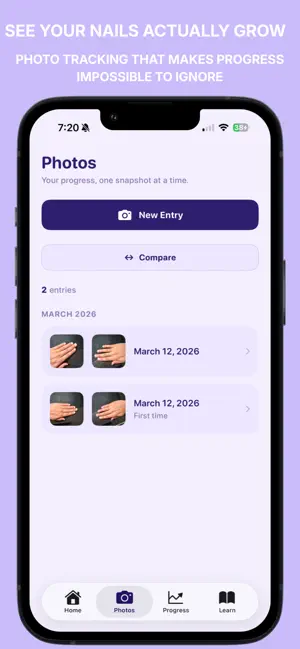 NoBite: Stop Nail Biting screenshot 2